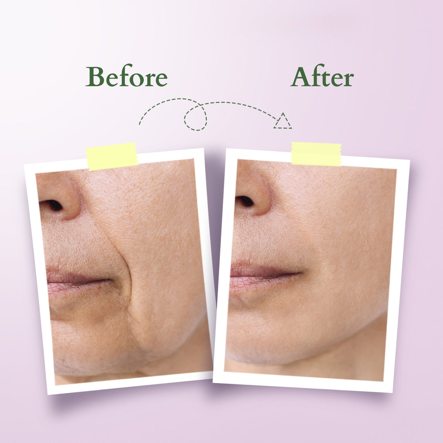 Bakuchiol Plant Retinol Crème